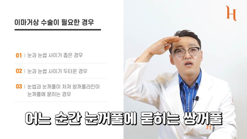 내시경이마거상 하면 안되는 이유 사진 4