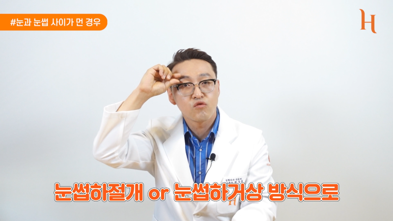 내시경이마거상 하면 안되는 이유 사진 7