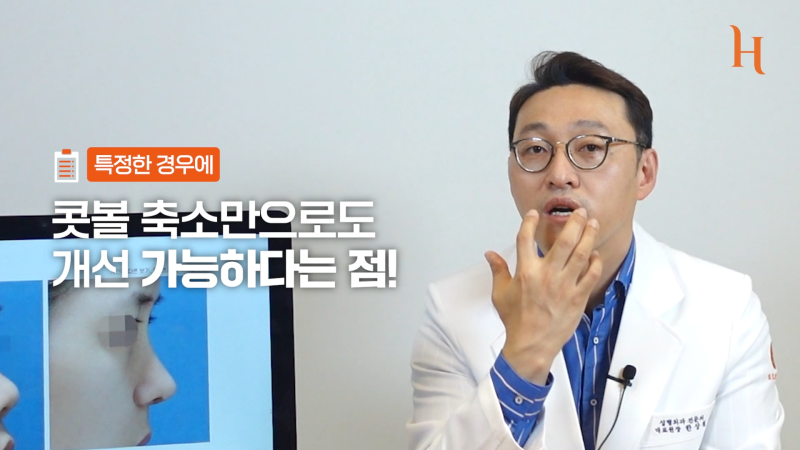 복코성형 콧볼축소만 해도 효과적 [히트성형외과] 사진 15
