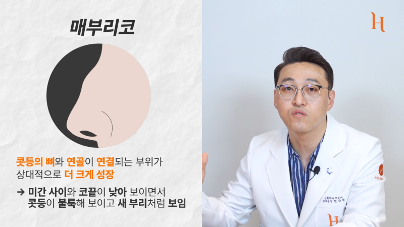 매부리코도 자라난다? 메부리 원인