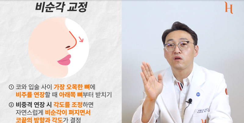 중안면부를 개선하는 인중각도 (비순각 교정, 고양이수술) 사진 4