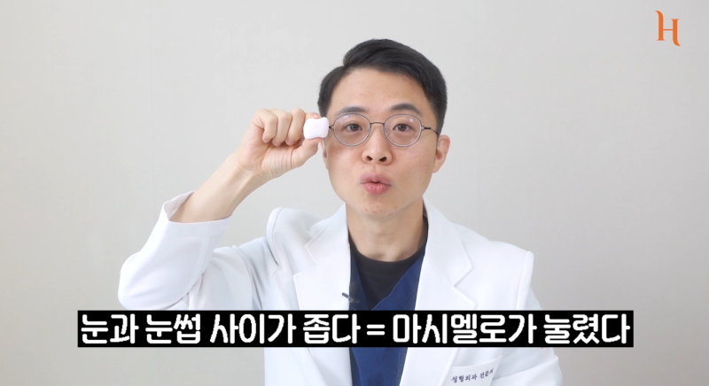 눈두덩이지방 = 마시멜로 (눈성형방법) 사진 5