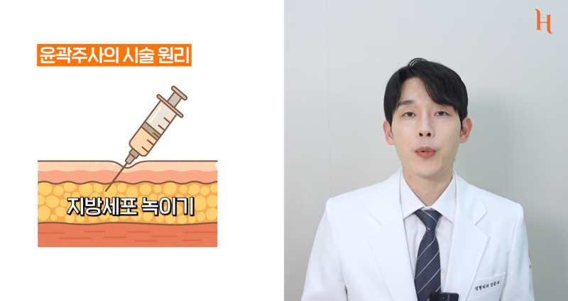 얼굴지방흡입 vs 윤곽주사 어떤 게 더 나을까? 사진 2