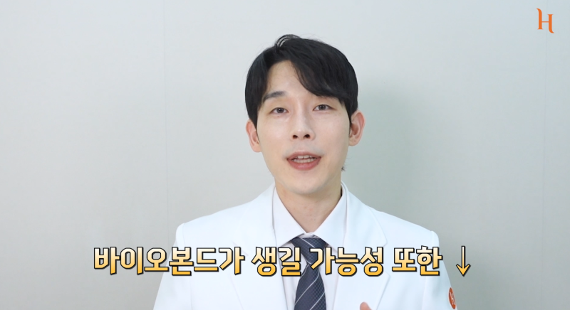 바이오본드 얼굴지방흡입 후 증상 사진 10