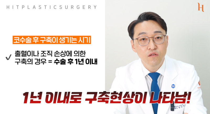 구축코를 예방하는 완벽한 방법은 없다? 사진 6