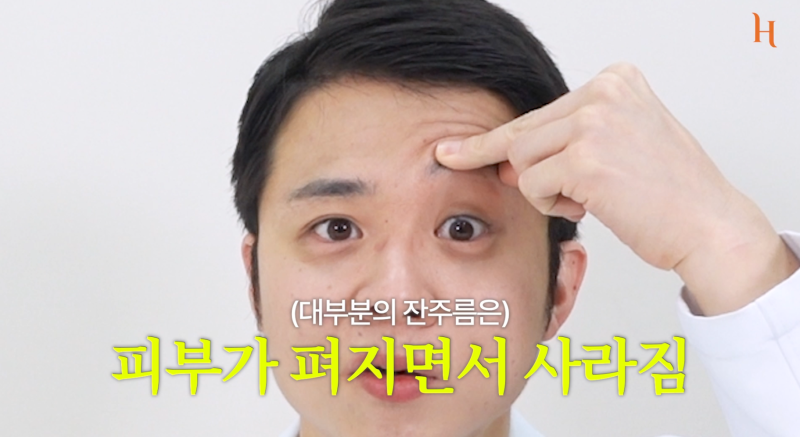 눈겹주름 쌍꺼풀이 아닙니다 사진 2