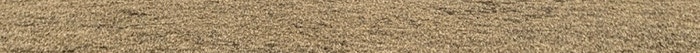 김해스킨보톡스 비포 애프터가 눈으로 보여 사진 25