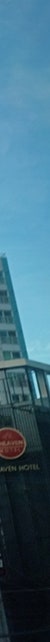 김해코재수술 병원 선택 전 알아야 할 사항 사진 26