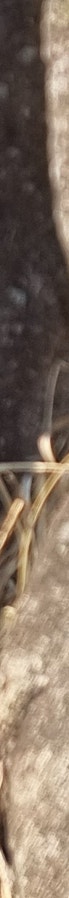 김해가슴재수술 케이스별 체크리스트 확인 사진 21
