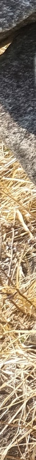 창원 쌍수 개인별 맞춤 디자인 성형외과 어디 사진 10