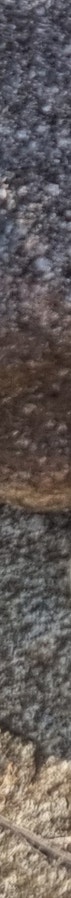 창원 쌍수 개인별 맞춤 디자인 성형외과 어디 사진 18