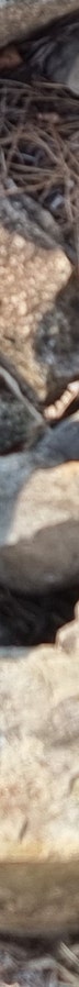 창원 쌍수 개인별 맞춤 디자인 성형외과 어디 사진 28