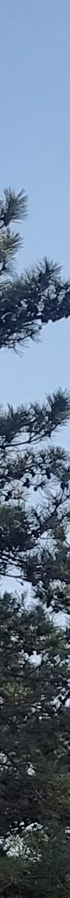 김해성형외과 쌍꺼풀 유형 맞춤 포인트 사진 24