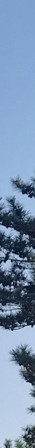 김해성형외과 쌍꺼풀 유형 맞춤 포인트 사진 12