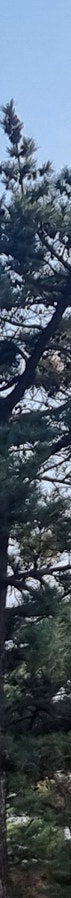 창원성형외과 쌍꺼풀 선택 시 주의할 점 사진 13