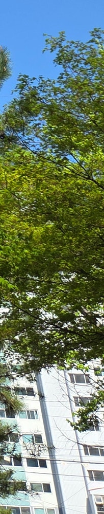 창원얼굴지방이식 잘하는곳 꺼진 부위 개선 사진 28