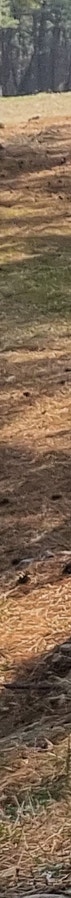 창원성형외과 눈성형 선택 주의사항 사진 14
