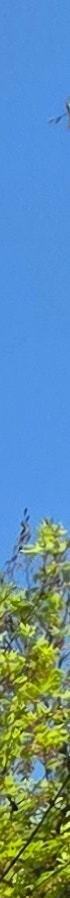 김해 실리프팅 얼굴선 변화 원리 확인 사진 25