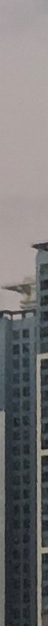 창원쌍꺼풀수술 변화 과정 확인 전 주의사항 사진 8