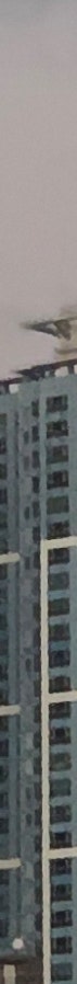 창원쌍꺼풀수술 변화 과정 확인 전 주의사항 사진 9