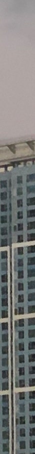 창원쌍꺼풀수술 변화 과정 확인 전 주의사항 사진 10