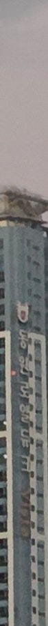 창원쌍꺼풀수술 변화 과정 확인 전 주의사항 사진 11
