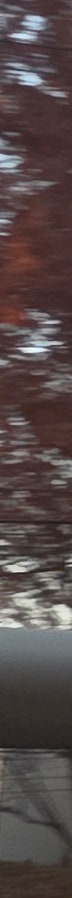 김해 필러 전후 변화 확인 입술 이마 부위별 체크 사진 15
