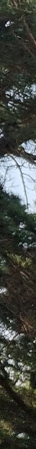 김해코성형 복코 휜코 유형 맞춤 개선방법 사진 27