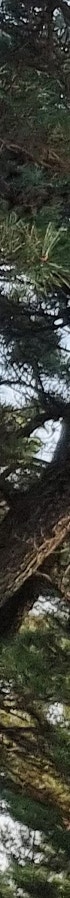 김해코성형 복코 휜코 유형 맞춤 개선방법 사진 22