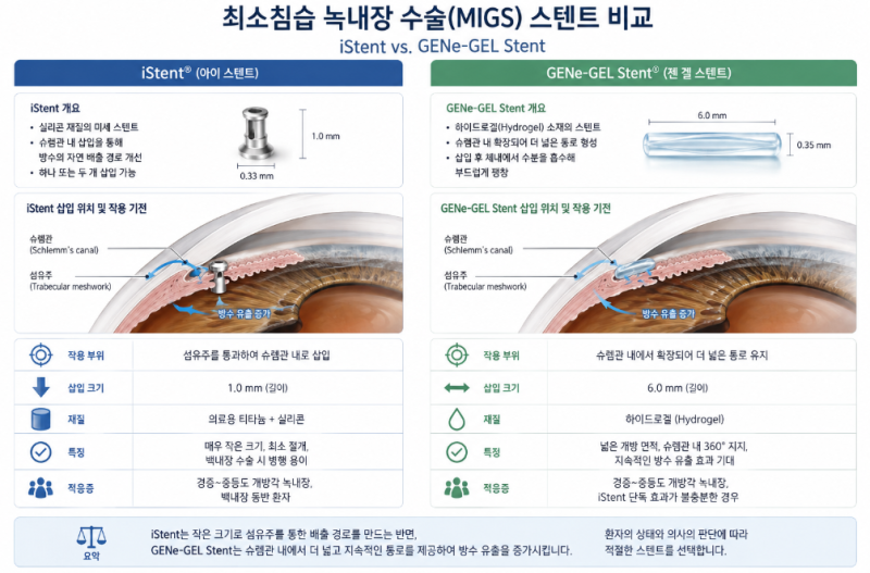[강남역 녹내장] 소리 없는 시력 도둑, 의학적 가이드라인에 따른 녹내장 치료 방법 총정리 (약물/레이저/수술) 사진 5