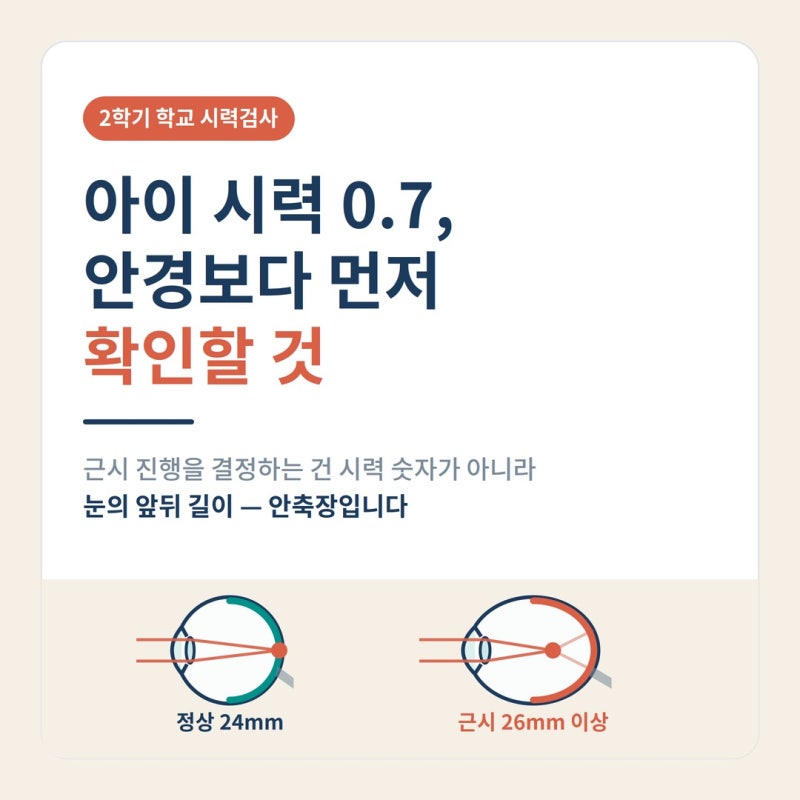 아이 시력 0.7 나왔다면? 초등학생 근시, 안경보다 먼저 확인할 것