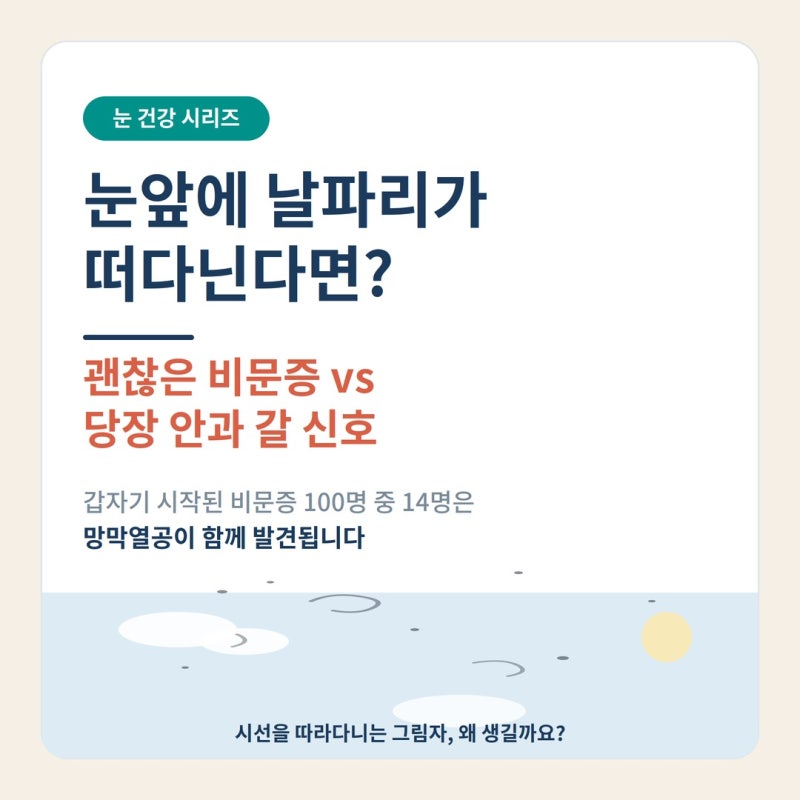 눈앞에 날파리가 떠다닌다면? 그냥 둬도 되는 비문증 vs 당장 안과 갈 신호