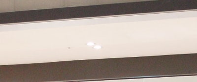 서면피코토닝 기미 주근깨 잡티 레이저로 깔끔하게 사진 32