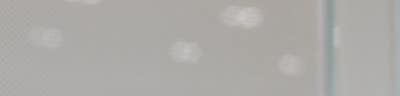 부산 서면 제이린의원 이정헌 대표원장님 리프팅 소개 사진 17