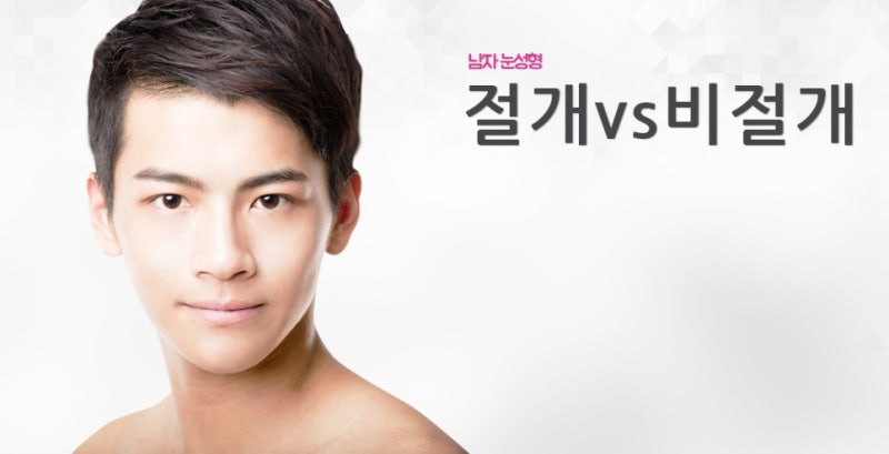 남자눈성형 무쌍눈매교정으로 자연스럽게 인상 변화