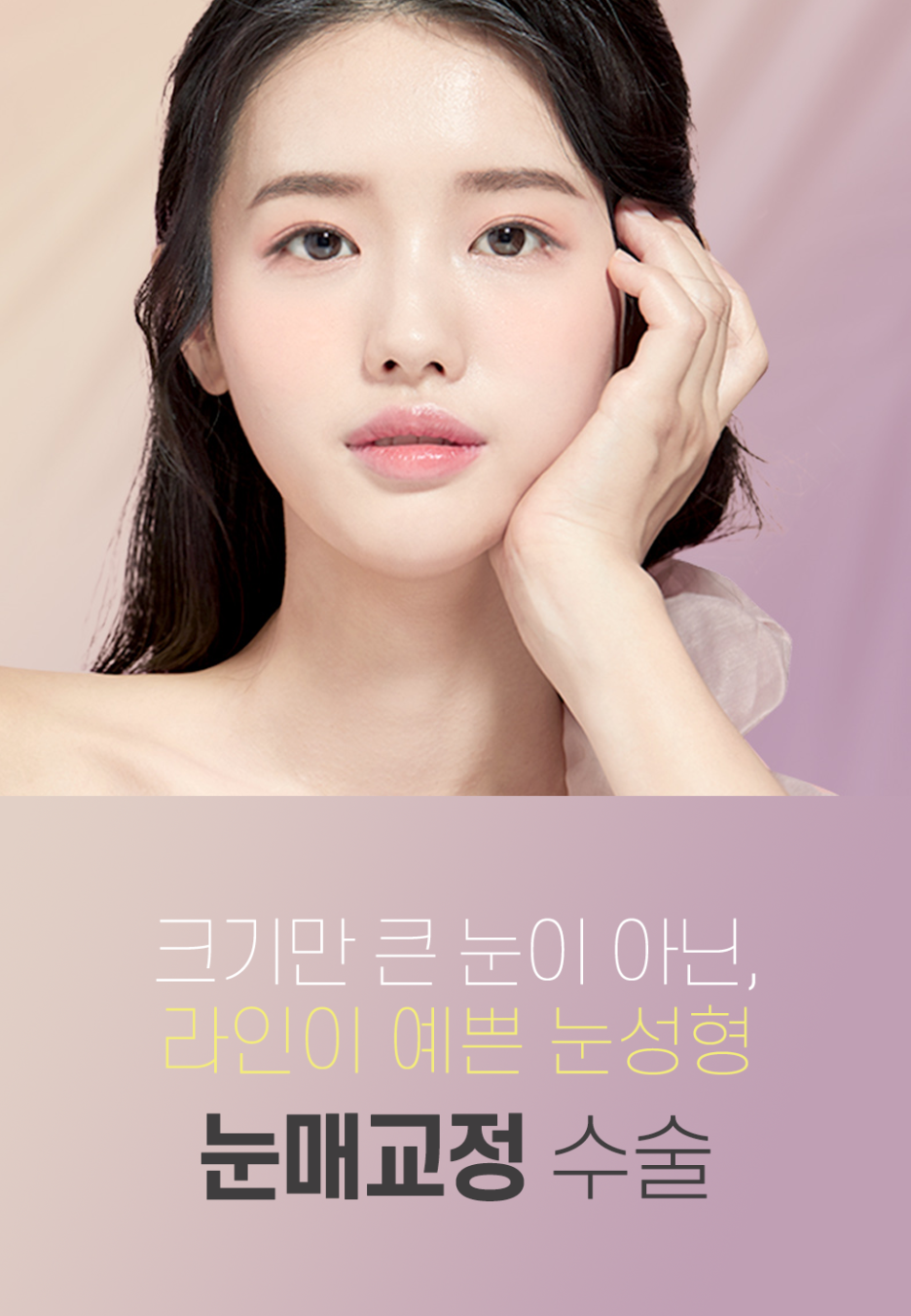눈매교정 수술로 아름다운 눈모양 만들기 사진 2