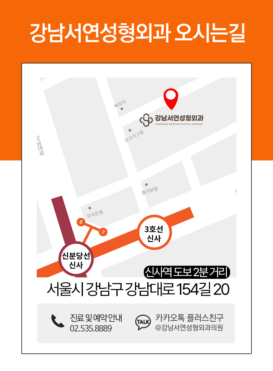 눈매교정 수술로 아름다운 눈모양 만들기 사진 18