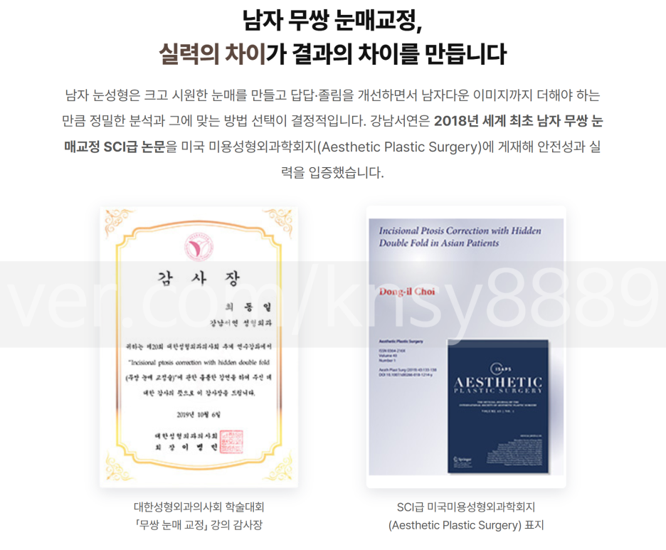 남자 쌍수 병원, 어떤 기준으로 골라야 할까요? 사진 7