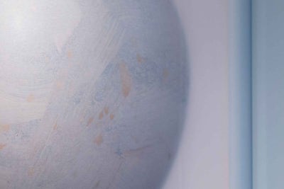 하지정맥류 주사치료 위험할까?김병준 원장 사진 19