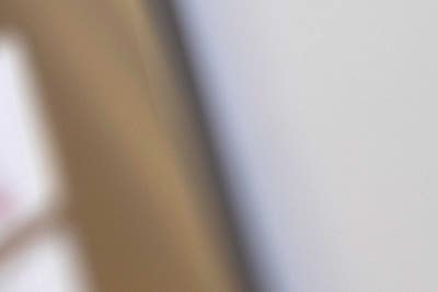 부산하지정맥류 임신 출산 후 계속된다면 사진 29