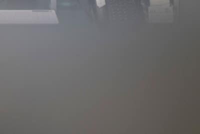 왼쪽 허벅지저림 허벅지통증 하지정맥류 증상 사진 16