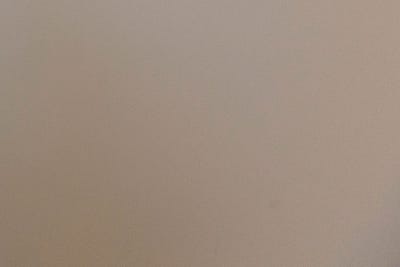 부산혈관초음파 하지정맥류 치료의 시작입니다 사진 19