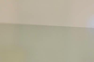 겨울 다리혈관질환 통증 원인은? 사진 10