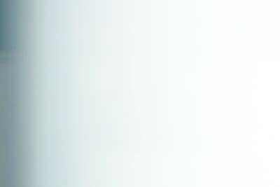 발목 가려움, 피부 변색? 하지정맥류 합병증 의심 사진 15
