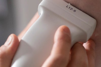 종아리 통증 오래 방치했다면, 하지정맥류 의심해보세요 사진 11