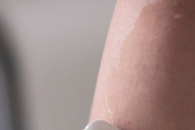 종아리 통증 오래 방치했다면, 하지정맥류 의심해보세요 사진 8