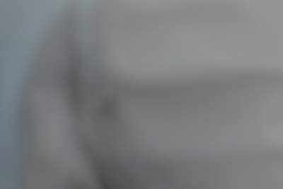 하지정맥류 주의, 40,50대 이후 다리가 무겁고 저리다면? 사진 13