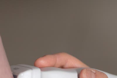 하지정맥류, 안 아파도 치료해야 하나요? 답을 알려드립니다 사진 10