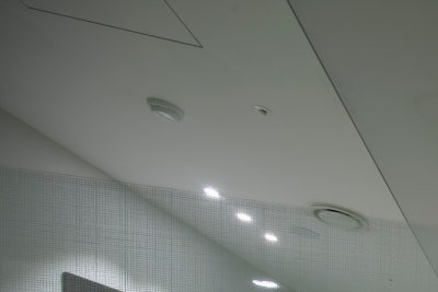 하지정맥류 초기증상~중증, 1~6단계 증상 확인 사진 12