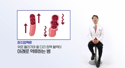 김병준 원장이 알려주는 하지정맥류 치료의 필요성 사진 5